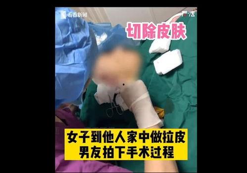 新疆医美事故爆料视频,揭秘美容行业安全隐患